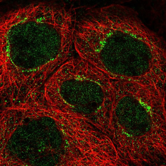 CEP83 Antibody in Immunocytochemistry (ICC/IF)