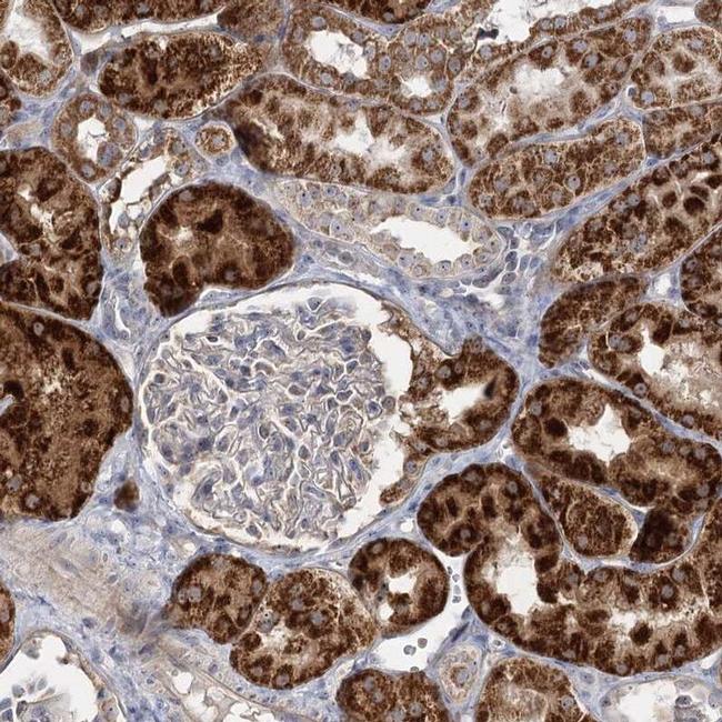 SUOX Antibody in Immunohistochemistry (IHC)