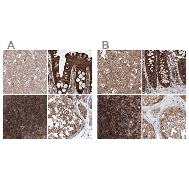 VPS37B Antibody in Immunohistochemistry (IHC)