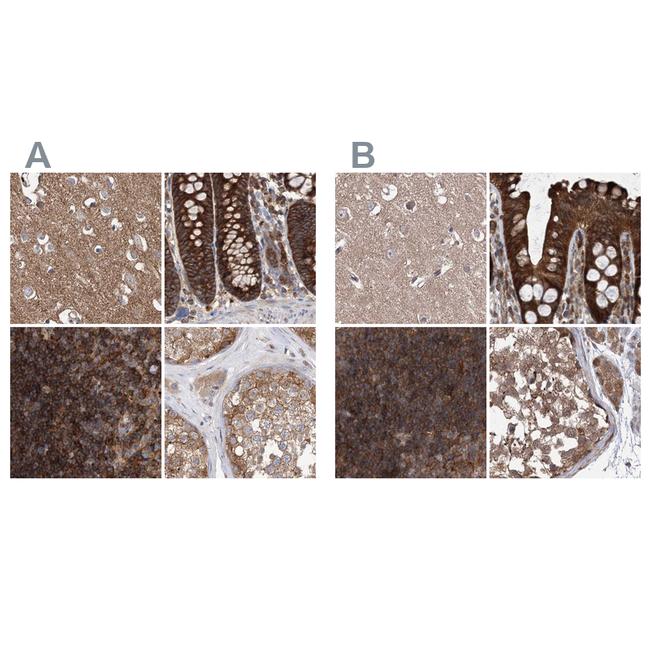 VPS37B Antibody in Immunohistochemistry (IHC)