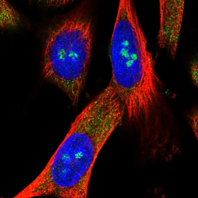 METL5 Antibody in Immunocytochemistry (ICC/IF)