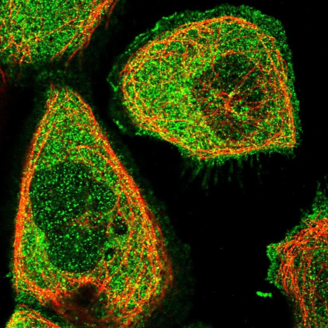 Triadin Antibody in Immunocytochemistry (ICC/IF)