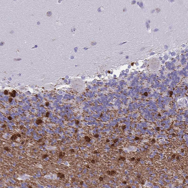 ERMN Antibody in Immunohistochemistry (Paraffin) (IHC (P))