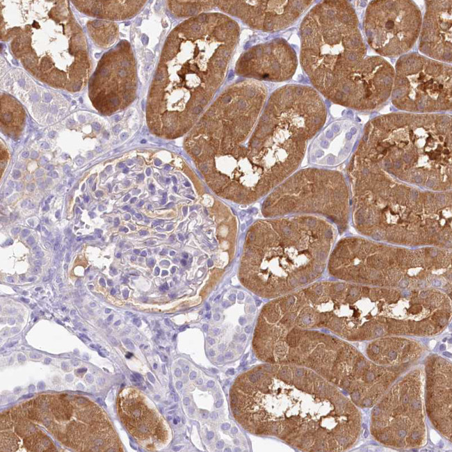 HPD Antibody in Immunohistochemistry (Paraffin) (IHC (P))