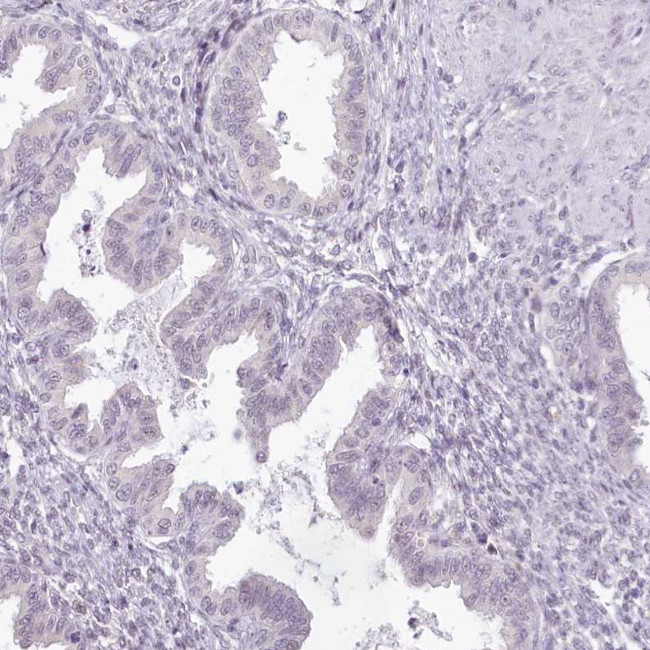 HPD Antibody in Immunohistochemistry (Paraffin) (IHC (P))