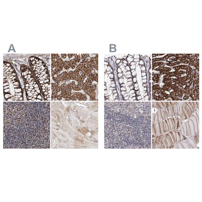 C5orf33 Antibody in Immunohistochemistry (IHC)