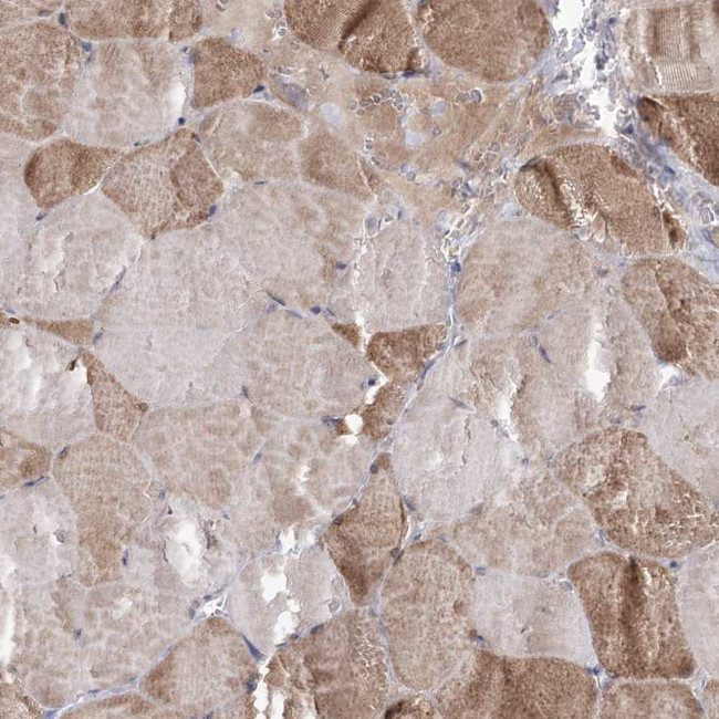 C5orf33 Antibody in Immunohistochemistry (Paraffin) (IHC (P))