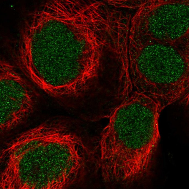 SynGAP Antibody in Immunocytochemistry (ICC/IF)