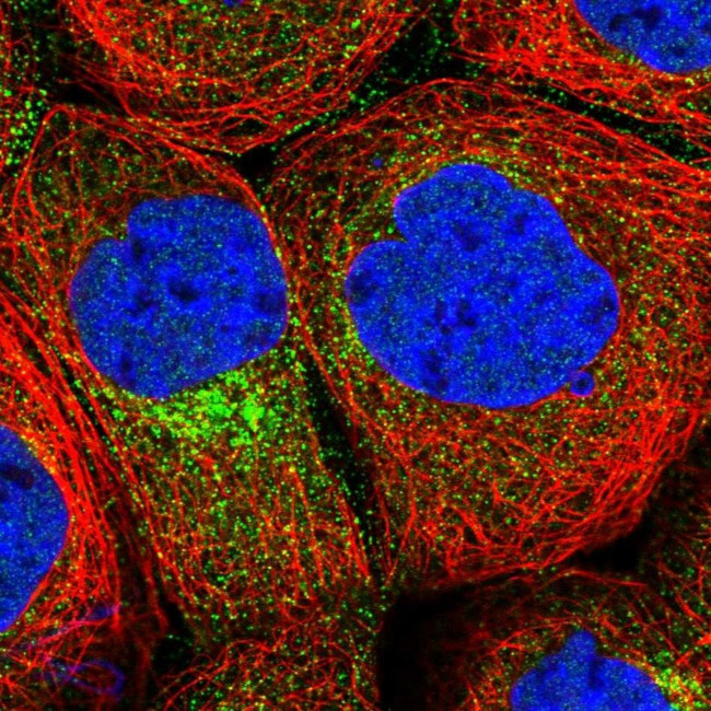 CPEB4 Antibody in Immunocytochemistry (ICC/IF)