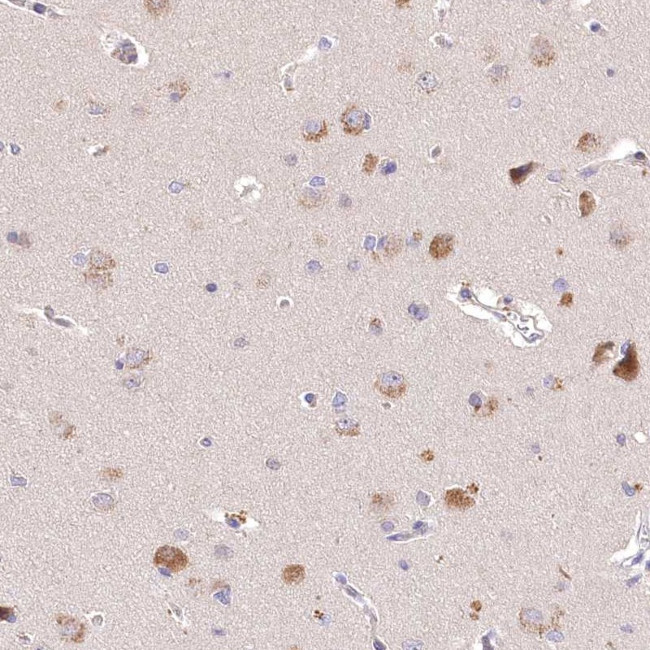 PCYOX1L Antibody in Immunohistochemistry (Paraffin) (IHC (P))