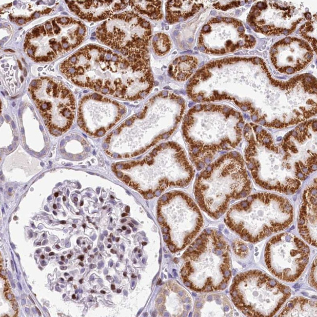 PPIP5K2 Antibody in Immunohistochemistry (Paraffin) (IHC (P))