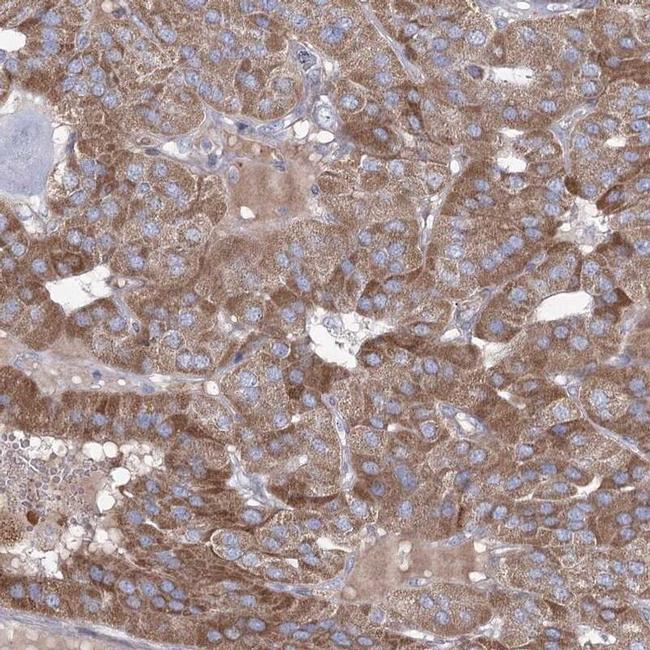 ME3 Antibody in Immunohistochemistry (IHC)