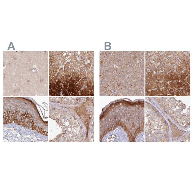 HAL Antibody in Immunohistochemistry (IHC)