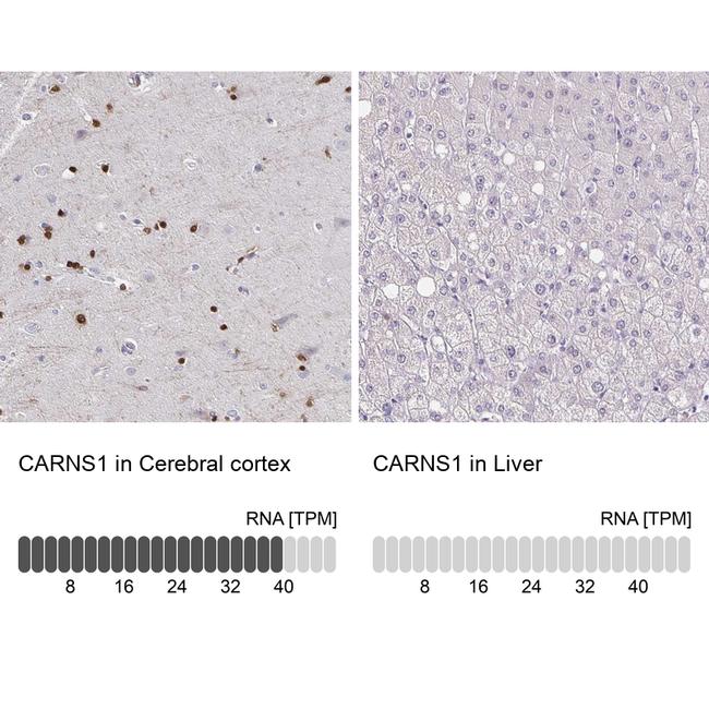 ATPGD1 Antibody in Immunohistochemistry (IHC)