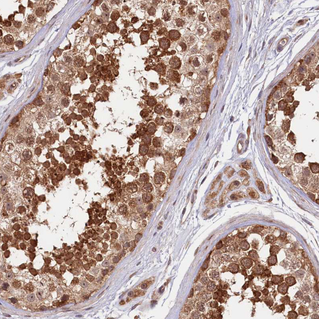 NEDD1 Antibody in Immunohistochemistry (Paraffin) (IHC (P))