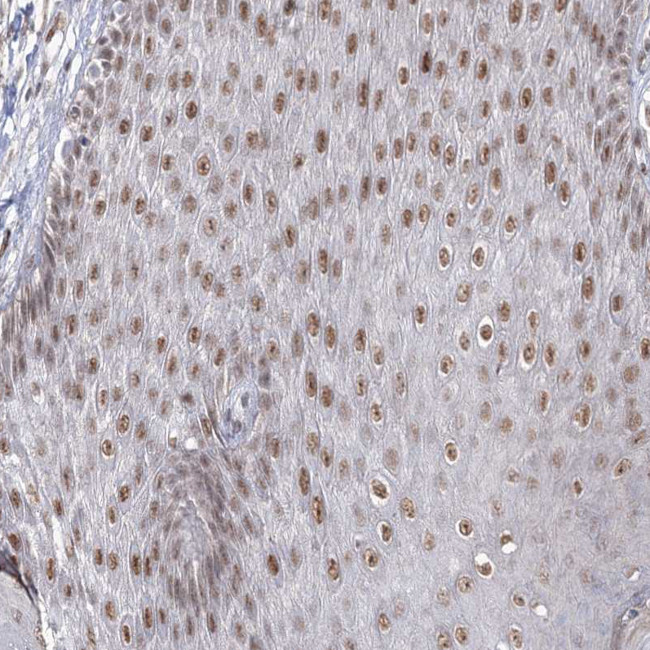 VGLL4 Antibody in Immunohistochemistry (Paraffin) (IHC (P))