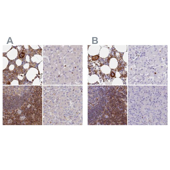 BIN2 Antibody in Immunohistochemistry (IHC)