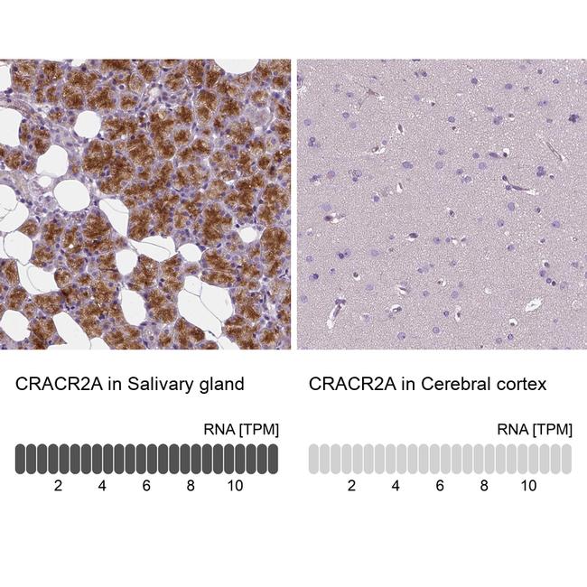 EFCAB4B Antibody in Immunohistochemistry (IHC)