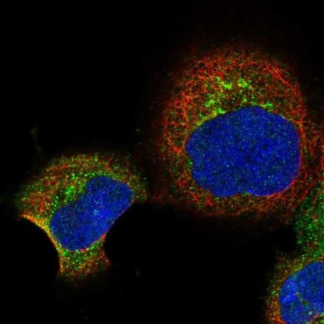 RBP5 Antibody in Immunocytochemistry (ICC/IF)