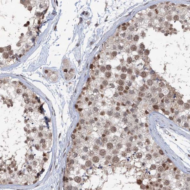 PHF8 Antibody in Immunohistochemistry (Paraffin) (IHC (P))