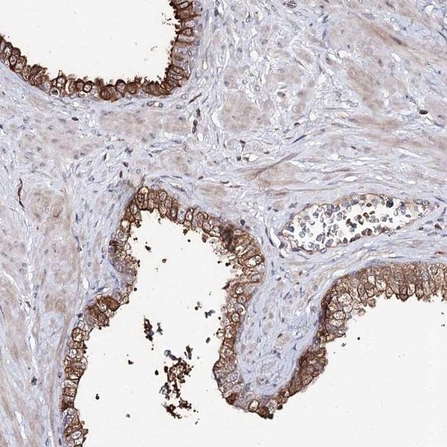 RRP9 Antibody in Immunohistochemistry (IHC)