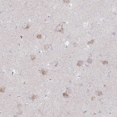 NAGLU Antibody in Immunohistochemistry (Paraffin) (IHC (P))