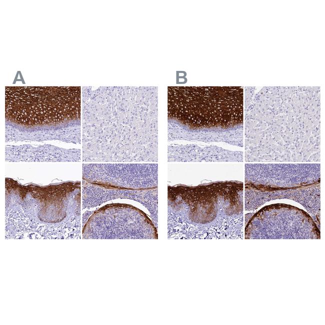 A2ML1 Antibody in Immunohistochemistry (IHC)