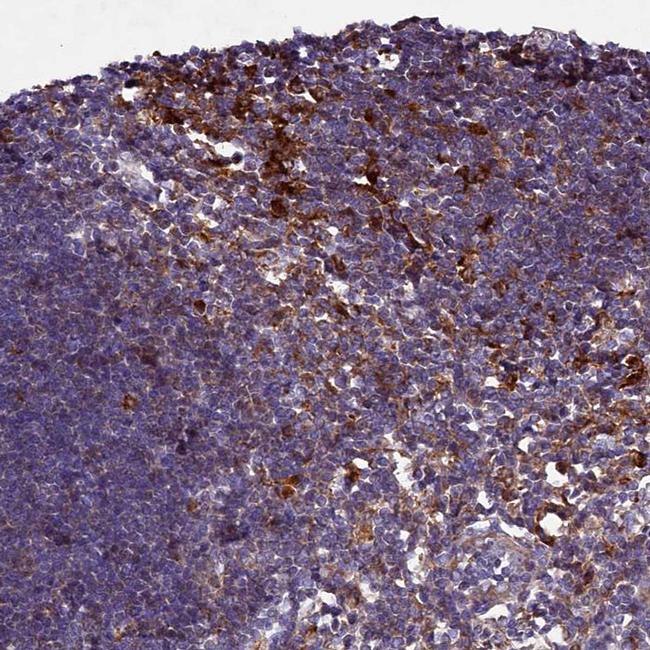 HDC Antibody in Immunohistochemistry (IHC)