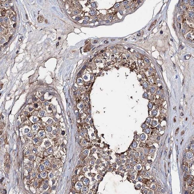 PTDSS2 Antibody in Immunohistochemistry (IHC)