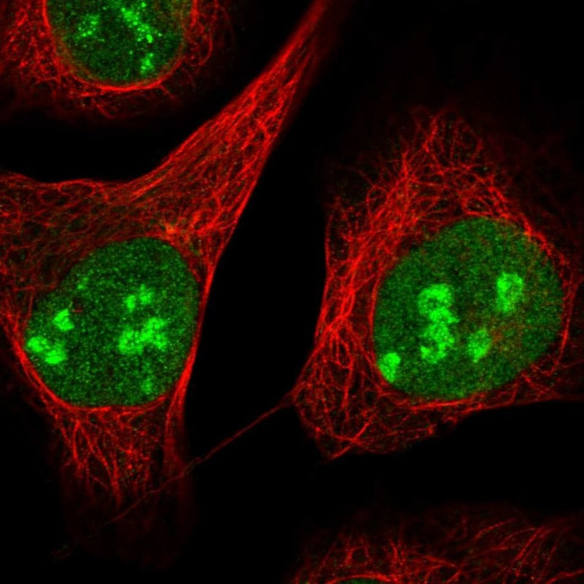 ZCCHC10 Antibody in Immunocytochemistry (ICC/IF)