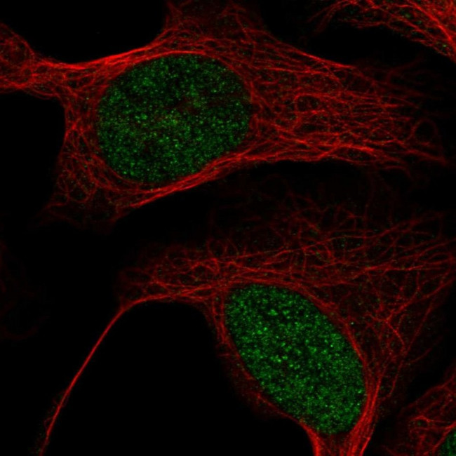 MBD6 Antibody in Immunocytochemistry (ICC/IF)