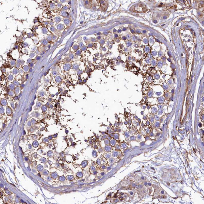 ANO6 Antibody in Immunohistochemistry (Paraffin) (IHC (P))