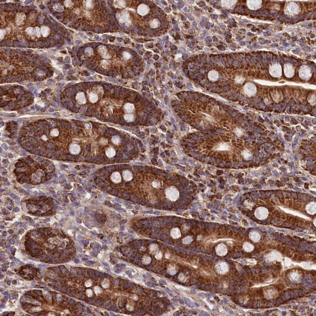 NUDT15 Antibody in Immunohistochemistry (Paraffin) (IHC (P))