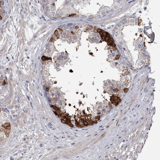 FDXACB1 Antibody in Immunohistochemistry (Paraffin) (IHC (P))