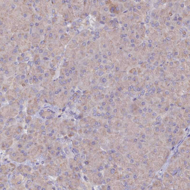 METTL20 Antibody in Immunohistochemistry (Paraffin) (IHC (P))