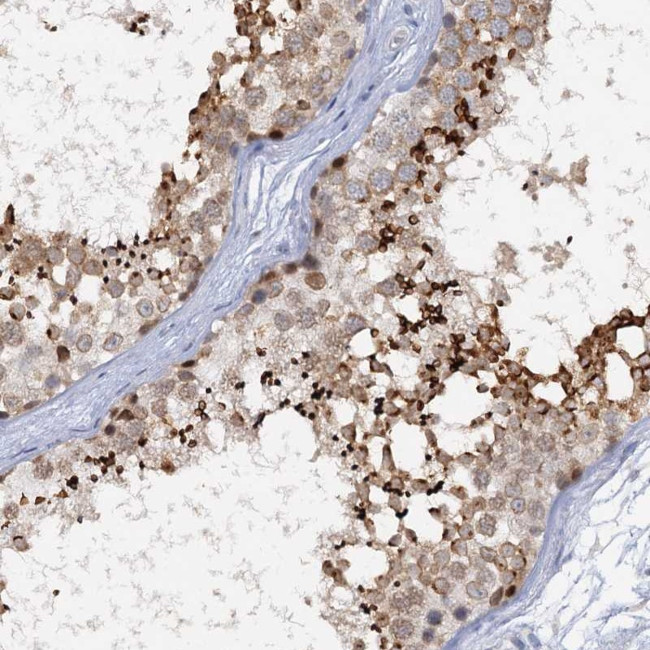 ACRBP Antibody in Immunohistochemistry (Paraffin) (IHC (P))