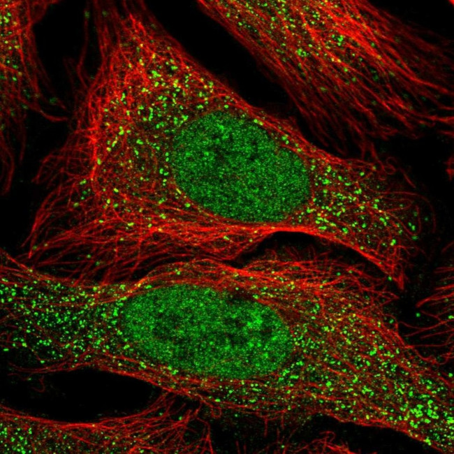 ACRBP Antibody in Immunocytochemistry (ICC/IF)