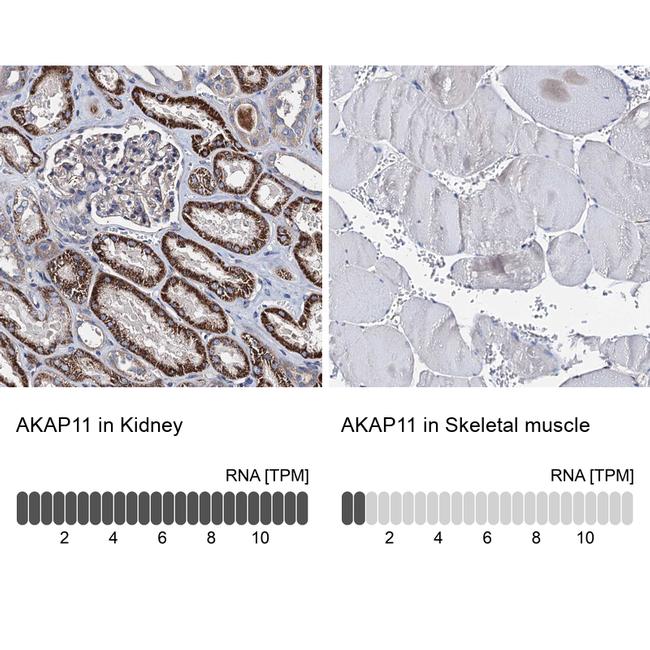 AKAP11 Antibody in Immunohistochemistry (IHC)