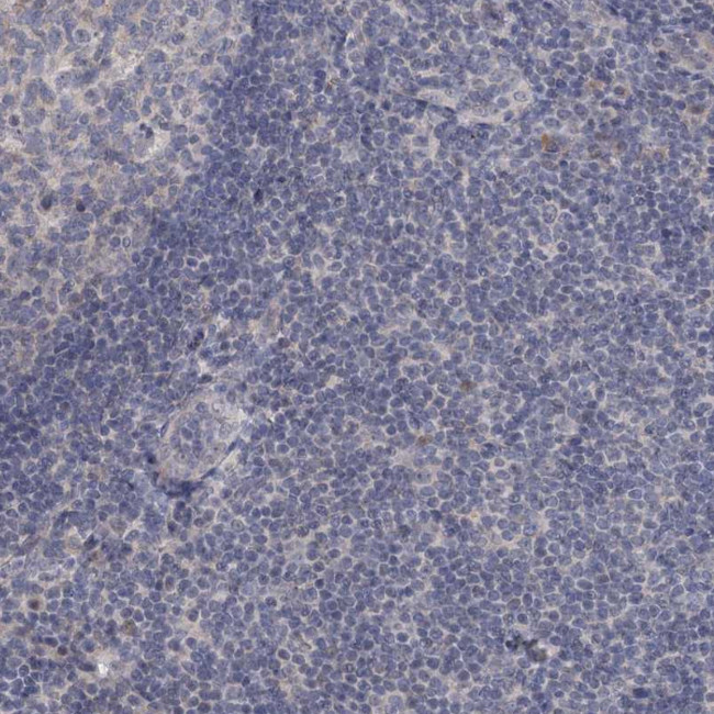 MUCL1 Antibody in Immunohistochemistry (Paraffin) (IHC (P))