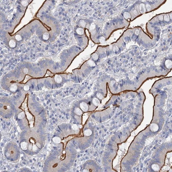 MYO7B Antibody in Immunohistochemistry (Paraffin) (IHC (P))