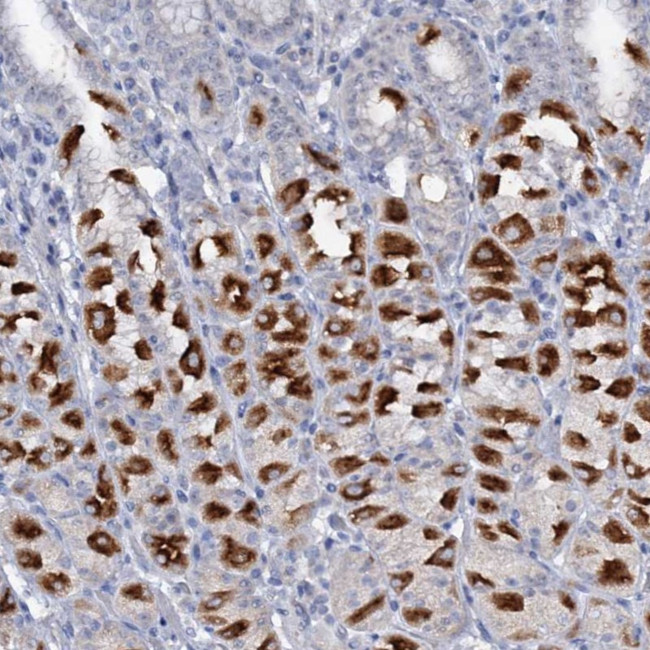 ATP4A Antibody in Immunohistochemistry (Paraffin) (IHC (P))