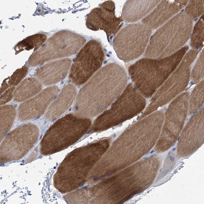 MYOZ3 Antibody in Immunohistochemistry (Paraffin) (IHC (P))