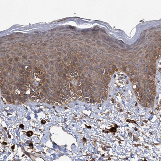 IDI1 Antibody in Immunohistochemistry (Paraffin) (IHC (P))