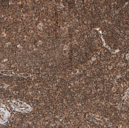 OTUB1 Antibody in Immunohistochemistry (Paraffin) (IHC (P))