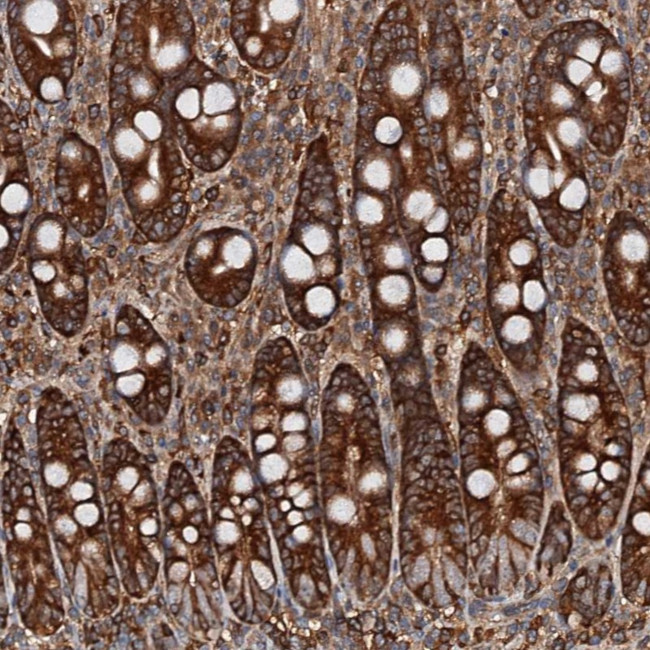 USP6NL Antibody in Immunohistochemistry (Paraffin) (IHC (P))