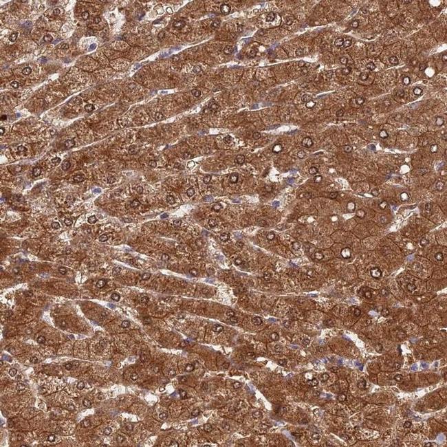 FUOM Antibody in Immunohistochemistry (IHC)