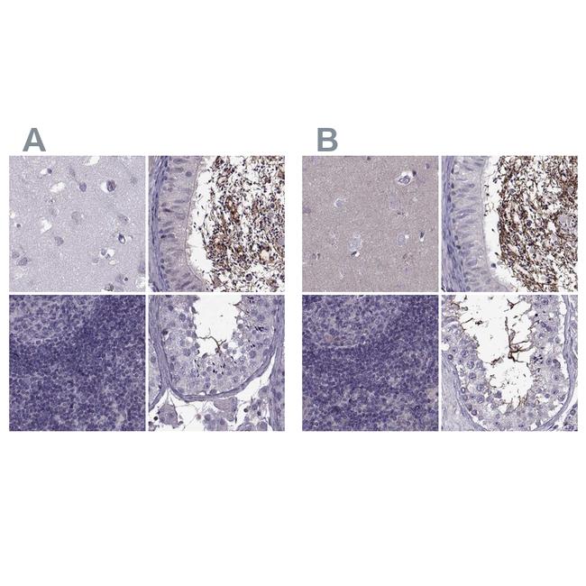 ODF3 Antibody in Immunohistochemistry (IHC)