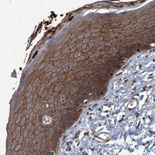 N4BP2L2 Antibody in Immunohistochemistry (Paraffin) (IHC (P))