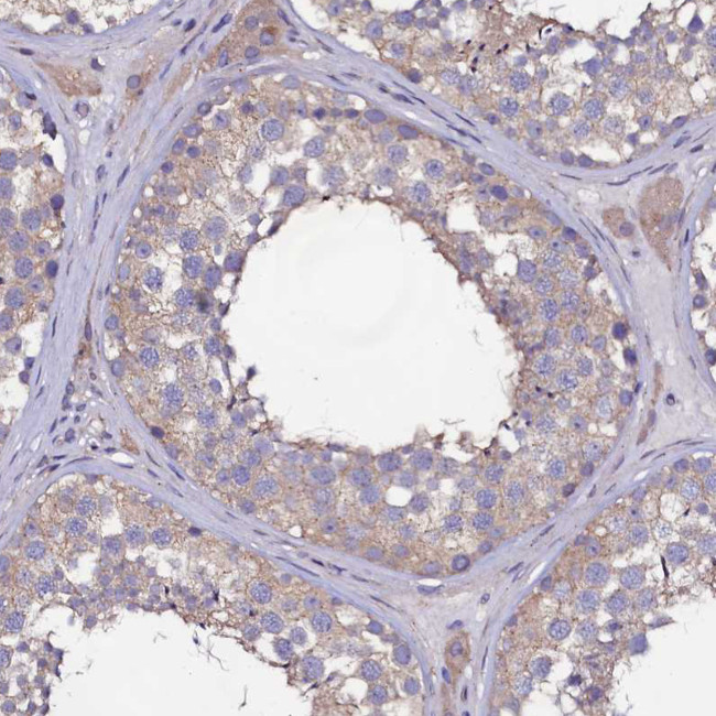 USPL1 Antibody in Immunohistochemistry (Paraffin) (IHC (P))