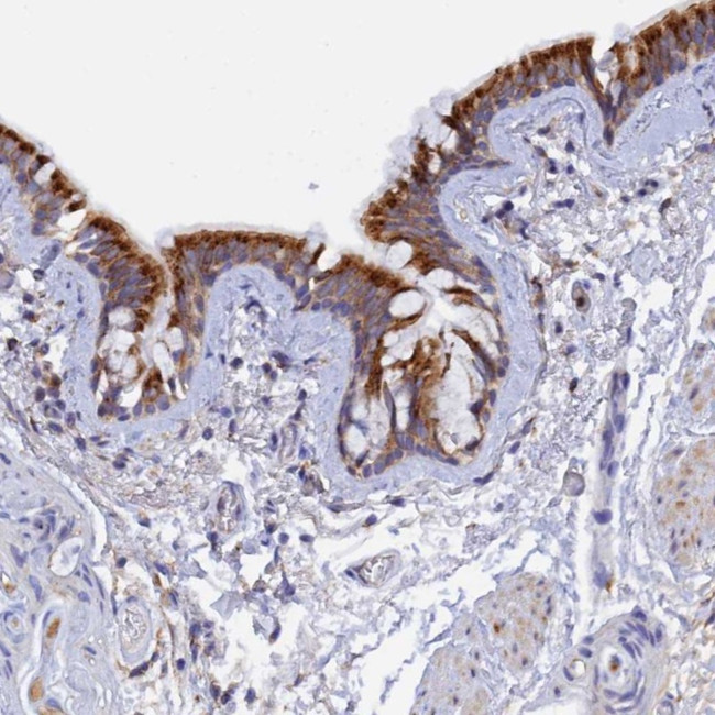 RPGRIP1L Antibody in Immunohistochemistry (Paraffin) (IHC (P))